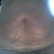 front (yuck)