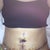 5 days PO pretty swollen
