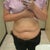 One month after treatment. You can see my waist getting smaller, and my hips are more contoured. The pictures don't do the procedure justice. I can see such a huge difference after just one month.