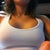 Post surgery pic
325cc mod plus under muscle