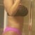 4 months after surgery...liking my overall shape...but would like a little more roundness on the top of my buns