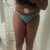 Post op day 3 front view. Swollen but beautiful! I'm a happy camper!