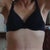 9 weeks post op.  
scars are fading!
