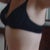 9 weeks post op, side view.