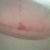 this is the "spot" under my left breast that is only now clearing up...grr!