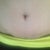 Up close scar