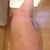 Day 7 - Front of Leg