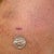 Day 7 - size of the incision next to a dime