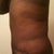 3 Weeks PO.  My side view is improving.  My scar is also fading fast.