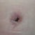Day 16 belly button, hardly draining