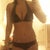 11 days post-op front