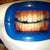 Zoom Whitening Community Photo