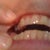 Zoom Whitening Community Photo