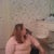 Sleeve Gastrectomy Community Photo