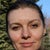 Microdermabrasion Community Photo