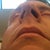 Septoplasty Community Photo