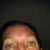 Jessner Peel Community Photo