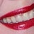 Dental Implants Community Photo