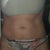 Lipotherme Community Photo
