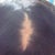 Scar Removal Community Photo