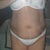 Lipotherme Community Photo