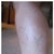 Sclerotherapy Community Photo