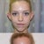 Ear Surgery Community Photo
