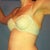 VASER Shape Community Photo