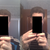 Ear Surgery Community Photo