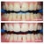 Teeth Whitening Community Photo