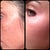 Photofacial Community Photo
