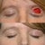 Facial Reconstructive Surgery Community Photo
