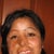 Facial Reconstructive Surgery Community Photo