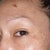 Photofacial Community Photo