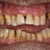 Dental Implants Community Photo