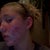 Acne Treatment Community Photo