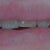 Damon Braces Community Photo