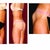 Butt Lift Community Photo