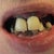 ClearChoice Dental Implants Community Photo