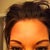 Eye Bags Treatment Community Photo