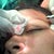 How to Create Natural Looking Eyebrows with Transplant Surgery [video]