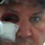 Mohs Surgery Community Photo