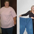 Gastric Bypass Guide