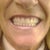 ClearChoice Dental Implants Community Photo