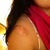 Scars Treatment Community Photo