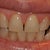 Teeth Whitening Community Photo
