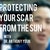 Surgery Scars: Protecting Your Scar from the Sun [VIDEO]