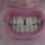 Damon Braces Community Photo