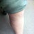Sclerotherapy Community Photo
