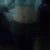 Butt Lift Community Photo
